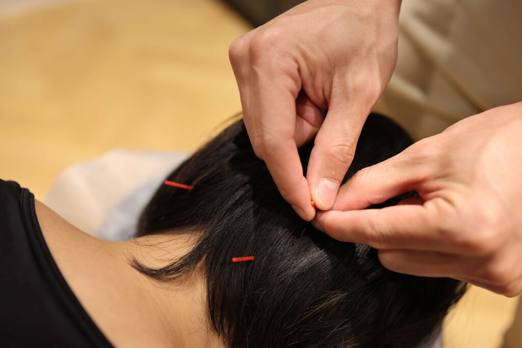 acupuncture chronic pain treatment Amsterdam
